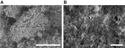 Effects of Contact Angle and Flocculation of Particles of Oligomer of Tetrafluoroethylene on Oil Foaming